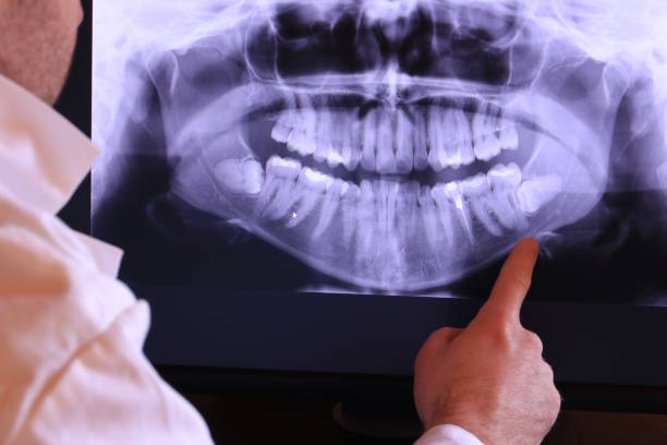 Best Emergency Dental Services for Seniors in Castle Pines Village, CO